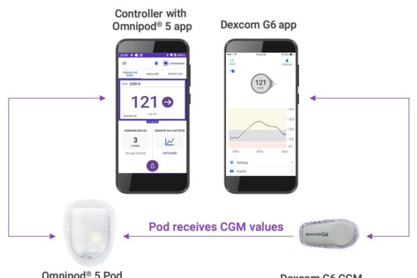 La boucle Omnipod 5 est enfin remboursée